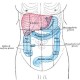 Irritable bowel syndrome diagnosis & treatment