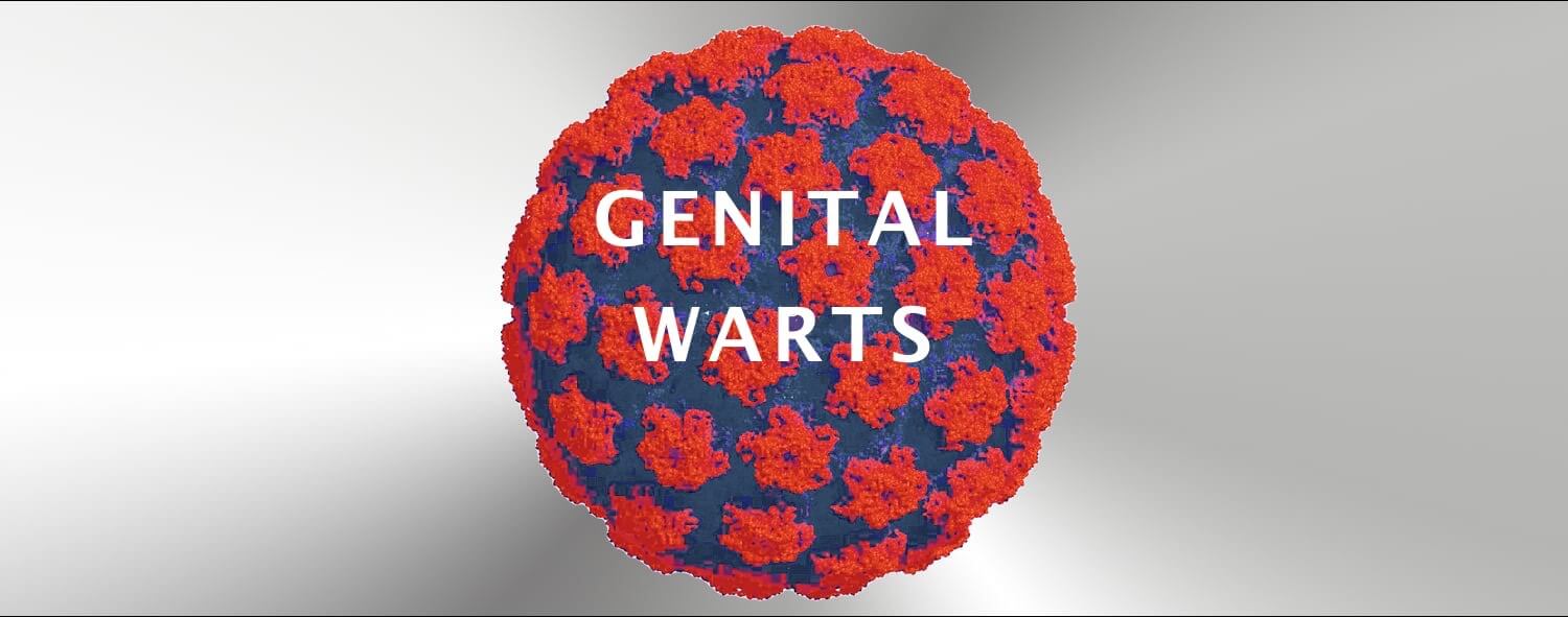 Genital Wart Treatment